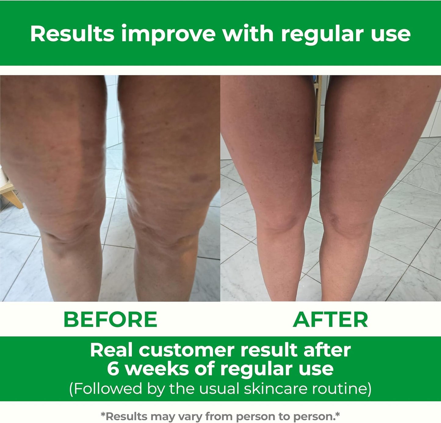 Anti-Cellulite Manual Massager Roller